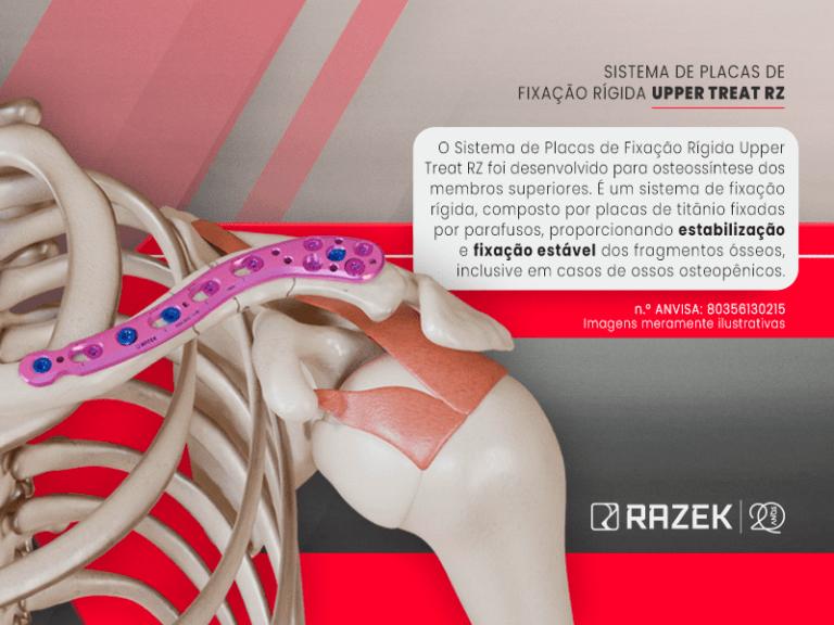 Banner home Mobile Sistema de Placas de Fixação Rígida Upper Treat RZ