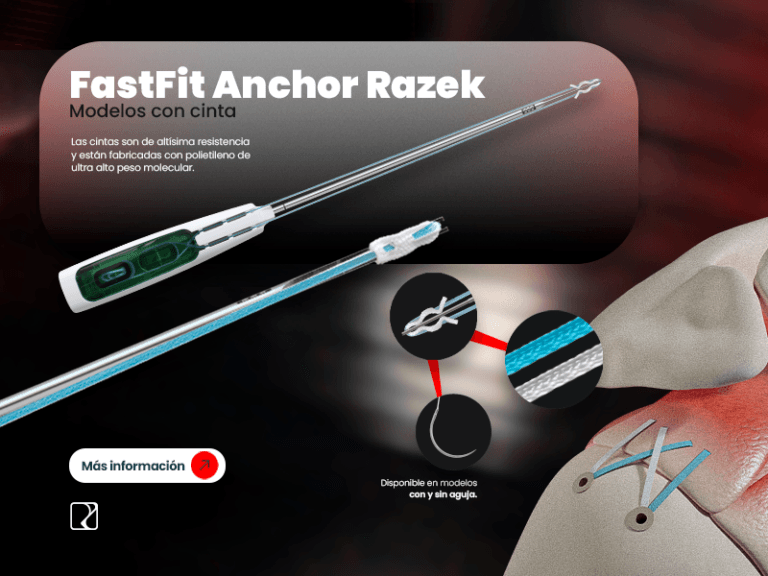 Banner MOBILE - FastFit Anchor Razek - modelo fita ES