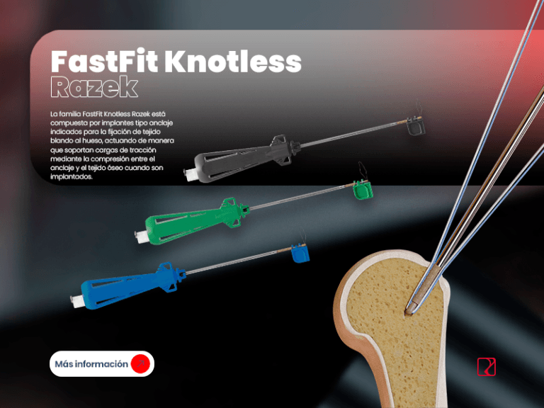 Banner MOBILE - FastFit Knotless ES