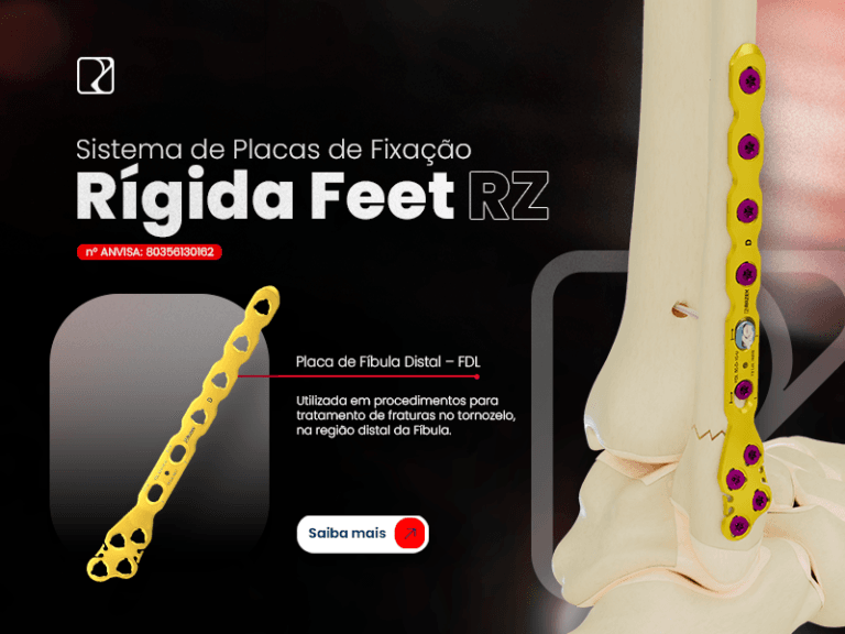 Banner MOBILE - Sistema de Placas Feet RZ