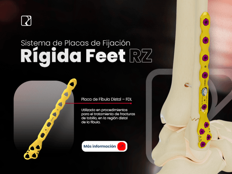 Banner MOBILE - Sistema de Placas Feet RZ ES